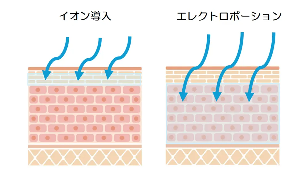 イオン導入とエレクトロポーションの浸透力の違い