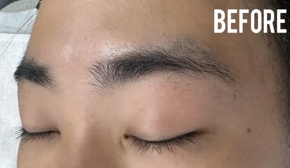 眉毛カットのビフォー(左眉)