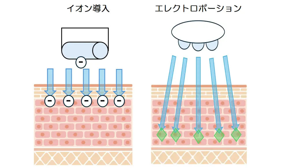 イオン導入とエレクトロポーションの仕組みの違い
